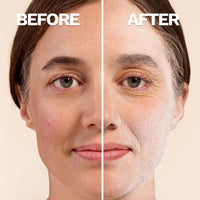 Before and After Results