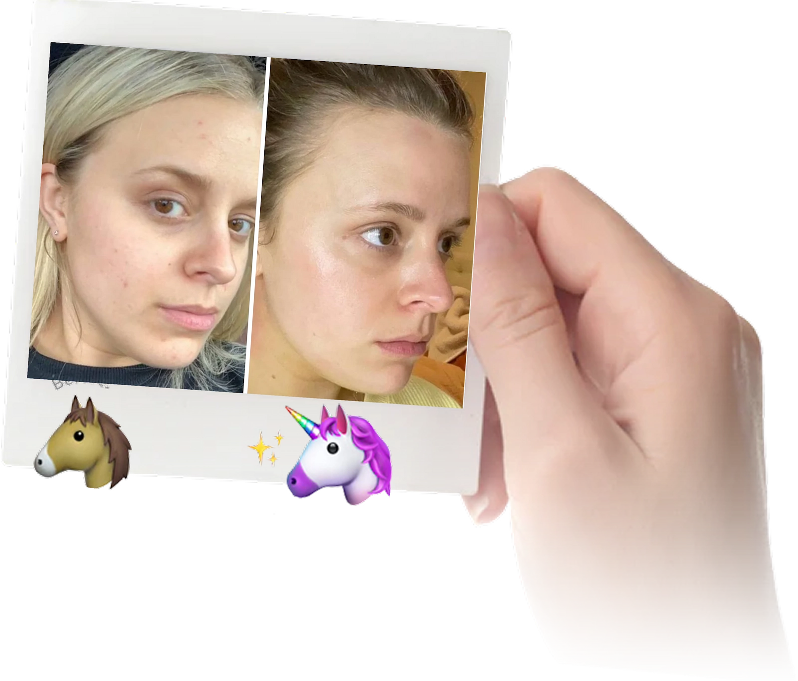 Before and after results